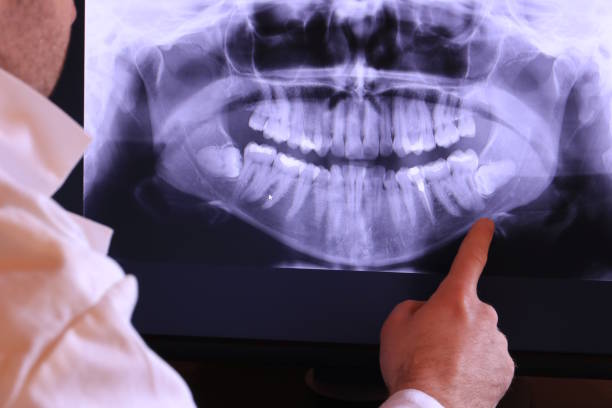 Best Walk-In Emergency Dentist in Oberlin, LA